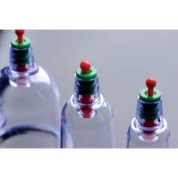 Master Series Sukshen 6 pc Cupping Set, image 5